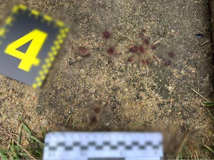  Під Києвом чоловікові розбили голову за зроблене зауваження 
