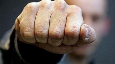  В Ровенской области умер водитель, избитый сыном пассажирки 
