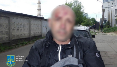 Зловмисник домовився з киянином про вигідний обмін $10 тис., а на зустрічі пограбував його