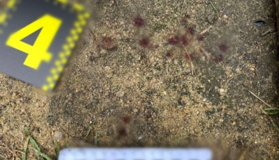 Під Києвом чоловікові розбили голову за зроблене зауваження